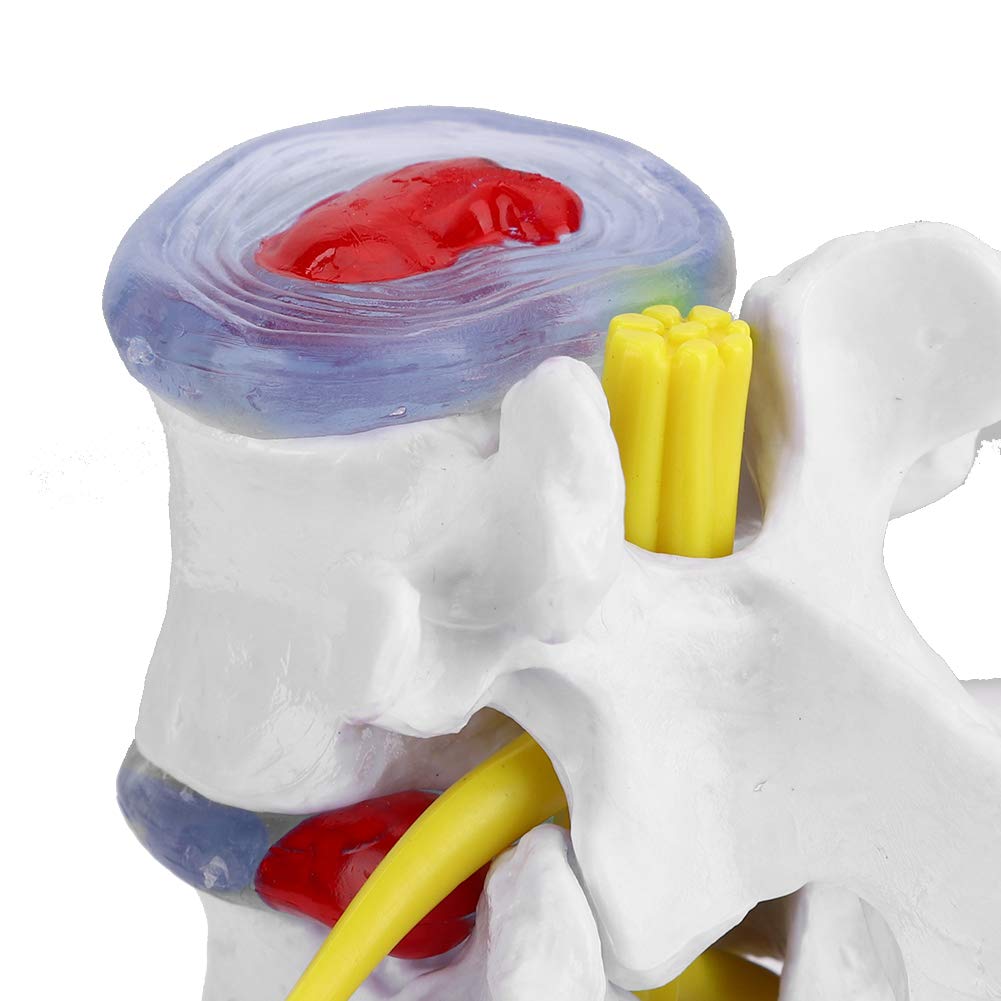 Menschliches Lendenwirbelmodell, menschliches anatomisches Skelettmodell Lendenwirbelmodell mit abnehmbarer Basis Einfach zu installieren Helfen Sie Menschen, den Zustand der Wirbelsäule zu überwachen