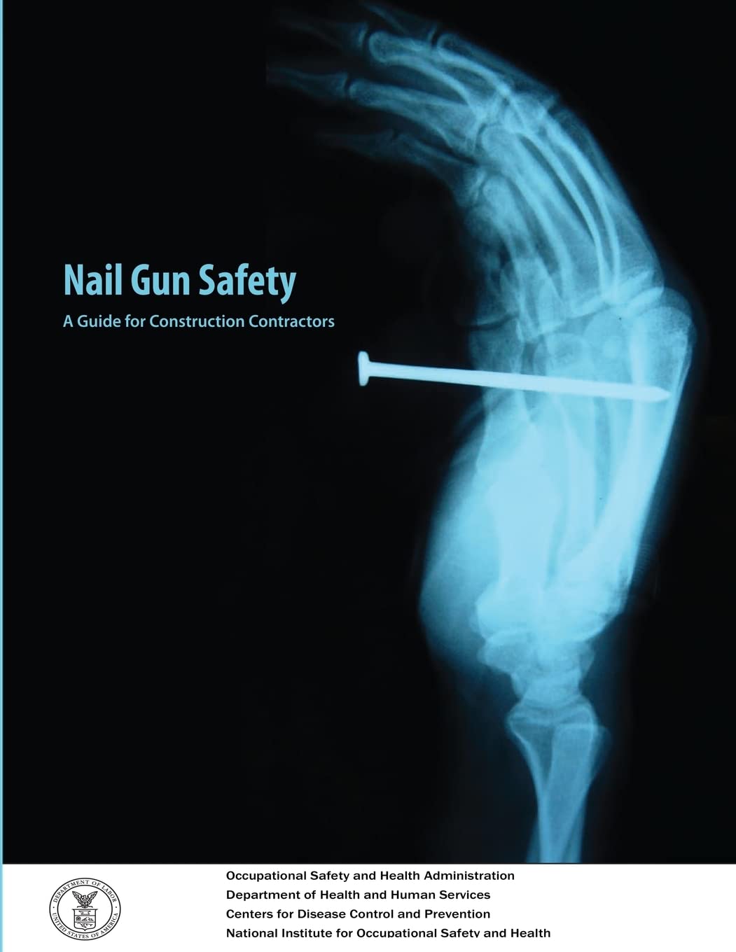 Nail Gun Safety: A Guide for Construction Contractors