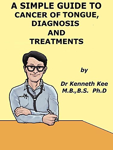 A Simple Guide to Cancer of the Tongue, Diagnosis and Treatment (A Simple Guide to Medical Conditions)