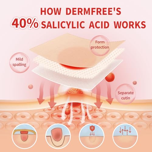 Image of Corn Remover Pads for Feet and Toes, 42 Count Maximum Strength Corn Removal Treatment with 40% Salicylic Acid, Fast Acting Wart and Corn Removal Bandages