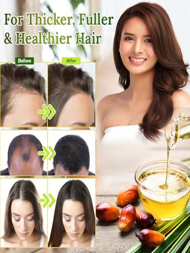 Batanaöl für Haarwachstum – Unraffiniertes natürliches Batanaöl revitalisiert die Haarstärke, rohes Batanaöl zur Behandlung von Haarausfall und zur Kopfhautpflege, Beseitigt Spliss (1 Pack)