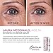 L’amore Beauty Intensive Eye Repair Serum (15 ml) Anti-Aging Collagen Booster Eye Cream with Retinol - Under Eye Treatment For Puffy Bags, Dark Spots, Fine Lines, Wrinkles - Made In USA
