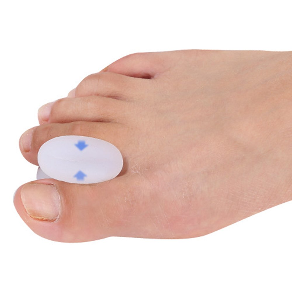 PedimendTM, separatori in gel per alluce valgo (3 paia, 6 pezzi), per uomini e donne, allevia il dolore indesiderato e l'attrito da spina ossea