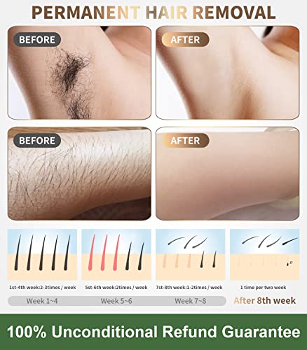 Image of IPL Laser Hair Removal Device for Women and Men - Permanent Painless 90% Hair Reduction in 4 Weeks, Whole Body Use (Armpits, Bikini Line, Face, Legs, Arms, Back) - Corded At-Home
