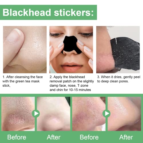Oewwex Green Tea Mask Clay Stick Blackhead Remover Pore Strips Combo Pack, 10 Pc Blackhead Acne Remover Patches Improve Skin Of Men And Women Deep Pore Cleansing #TOP2