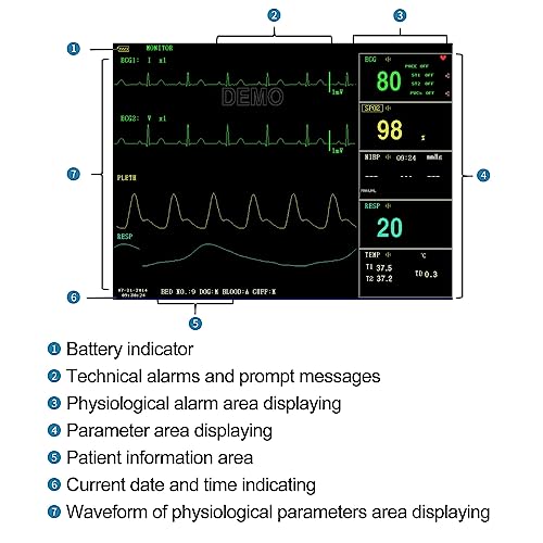 CONTEC Veterinary Patient Monitor Multi 6 Parameters Monitor for Pets Cats Dogs Animals Use in Home Clinic (CMS6000VET+Printer) - Thumbnail 3