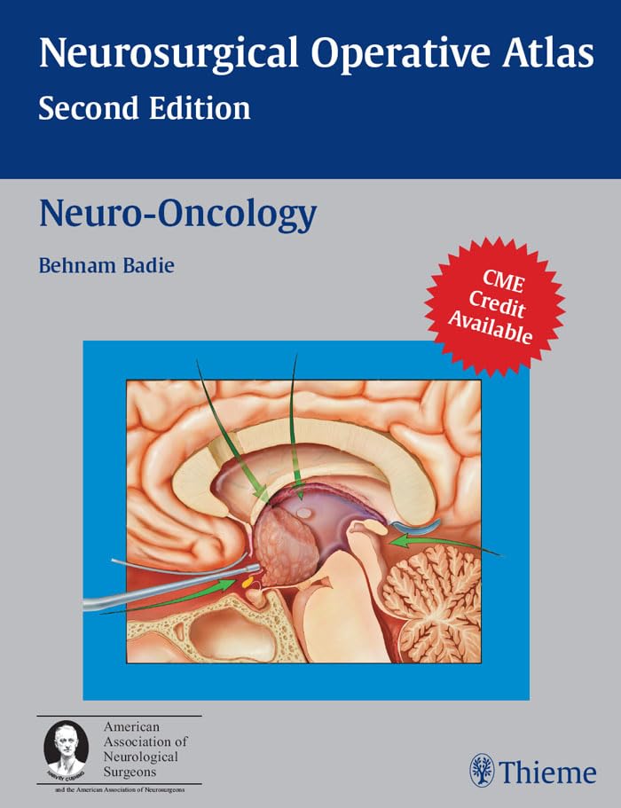 Neuro-Oncology (Neurosurgical Operative Atlas)