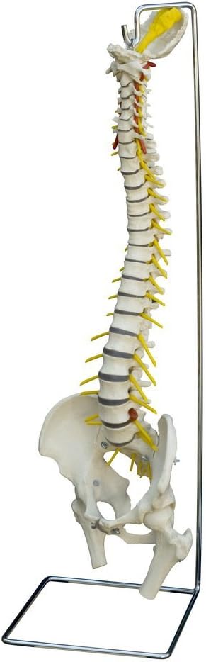 Spine With Herniated Disc/Anatomical Model