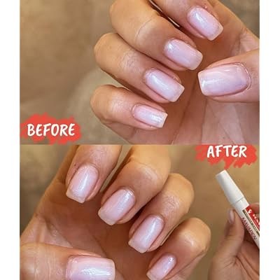 MAVALA Cuticle Oil Nail Care| Sulfate & Paraben Free | Cuticle Softener | Moisturizes Nail Bed | Improve Nail Appearance | Encourage Nail Growth | 0.3 Ounce