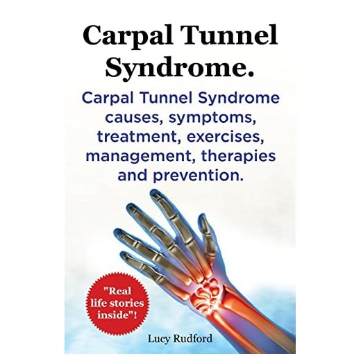 Carpal Tunnel Syndrome. Carpal Tunnel Syndrome causes, symptoms, treatment, exercises, management, therapies and prevention. Real Life Stories Inside!.