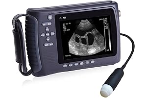Newest Doppler Ultrasound Machine for Home Pregnancy, Portable Handheld Doppler Fetal Monitor...