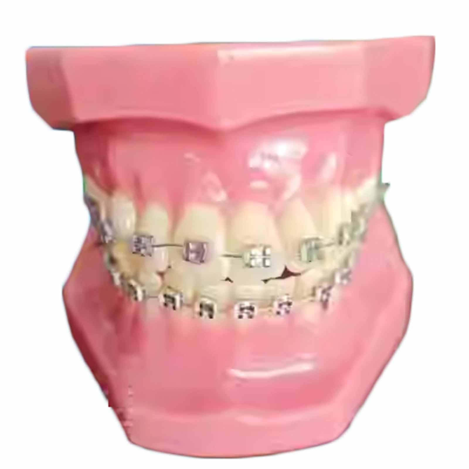Model Zamka Do Ćwiczeń Ortodontycznych – Model Demonstracyjny Ortodoncji Stomatologicznej Z Metalowym Zamkiem – Do Narzędzi Dydaktycznych (A8, 8 Cm),A8-8cm