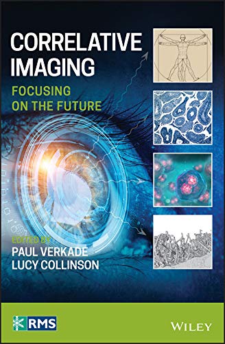 Correlative Imaging: Focusing on the Future (RMS - Royal Microscopical Society)