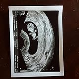 Custom 2D Prank Pregnancy Ultrasound Sonogram SINGLE PHOTO - REAL US PAPER