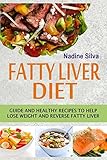 Fatty Liver Diet: Guide And Healthy Recipes To Help Lose Weight And Reverse Fatty Liver