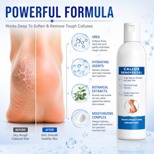 Image of Callus Remover Gel for Feet, Softening and Exfoliating Formula, Dry Rough Skin Care, 200ml, for Men and Women (1)