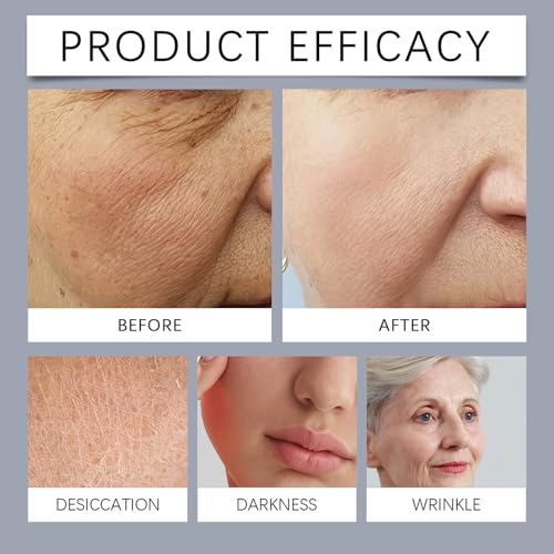 Grospe Bee Venom Collagen Stick,Anti-Wrinkle Firming Cream Stick, Lifting & Tightening Serum Stick,Hydrates and Nourishes Skin,Restore Skin Elasticity,Reduces Wrinkles,Skin Collagen Moisturizer for Dry Skin