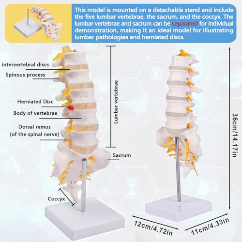 Image of 5 Section Lumbar Spine Model with Sacrum and Spinal Nerves,Life Size Vertebral Column Model for Chiropractic,Patient Education Demonstration,Excellent Way for Demonstrating Disc