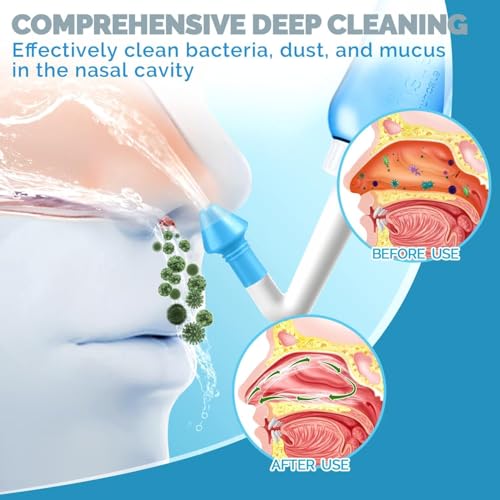 Image of Nasal Saline Jal Neti Pot Sinus Rinse Yoga Bottle System Irrigation 300 ML Control Wash Nose Cleaner Pressure Irrigation for Allergy Relief Cold with 2 nozzles for Adult & Kid BPA Free - 300ml