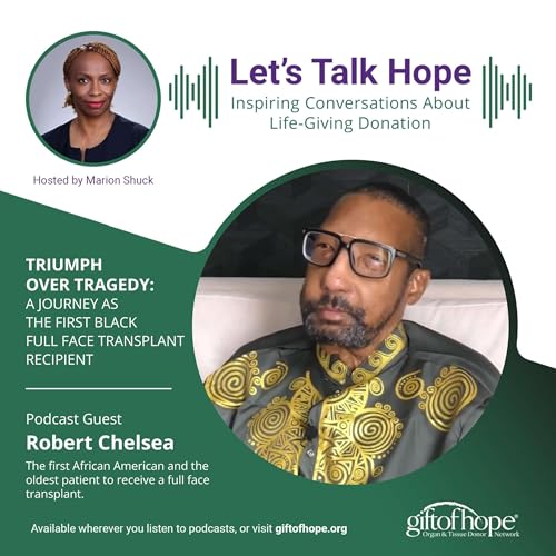 Triumph Over Tragedy: Robert Chelsea&rsquo;s Journey as the First Black Face Transplant Recipient