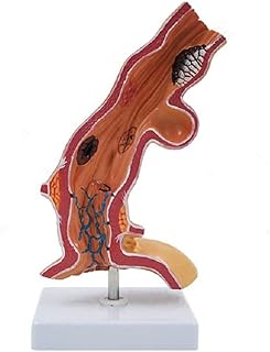 Oesophagus Pathology Model Human Digestive System Organ Esophagus Pathology Anatomical Model for Medical Anatomical Display Teaching