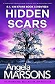 Hidden Scars