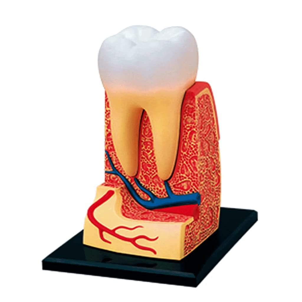 GTHTUHFD Skeleton Model Caries Teeth Model Anatomy Education Model Human Model Study Teeth Model Detachable Human Organ Model For Study