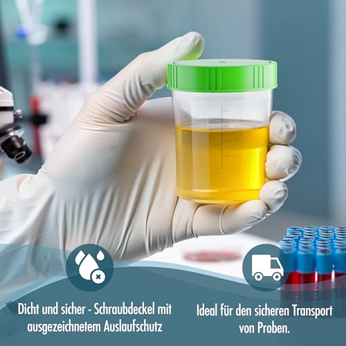 Theracaso Probenbecher Set – 10 Stück à 125 ml – inkl. 40 Etiketten - Auslaufsichere Urinbecher mit Schraubdeckel, graduiert bis 100ml – Für Küche, Basteln, Medizin, Urinproben -beschriftbar