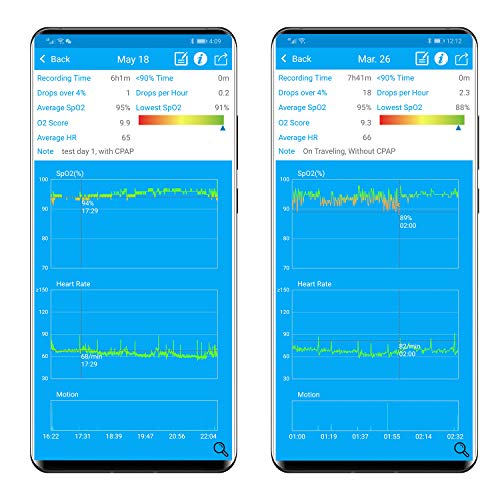 Lookee Oxring-Pro Oxygen Monitor With Vibration Reminder - Bluetooth O2 Pulse Oximeter Rechargeable, Continuous Recording Of Spo2 & Pr, Blood Oxygen Saturation Tracker With Free App & Pc Reports #TOP5