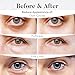 BLOOMORA Variety Under Eye Patches (20 Pairs) - Dark Circles & Puffiness Care - Eye Mask for Care - 5 Varieties