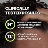 Scandinavian Biolabs Bio-Pilixin® Serum For Men | Helps Reduce Hair Loss Due to Breakage, Activate Hair Growth, Stem Cell Technology, Drug-Free, Clinically Tested, 100 mL / 3.4 Oz (1-Month) - Image 5