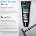 The Man Razor Bumps Serum - Ingrown Hair Treatment for Men - Razor Bump Treatment for Men - Face & Body After Shave & Razor Burn Treatment - Metal Roll On Soothes Skin & Calms Irritation (3.5fl.oz)