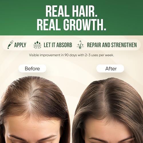 Morstar Batana Oil for Hair Growth - Dr Sebi Batana Hair Growth Oil from Honduras – 100% Pure, Natural & Cold-Pressed for Thicker, Longer Hair, Deep Hydration & Frizz Control 3.4oz