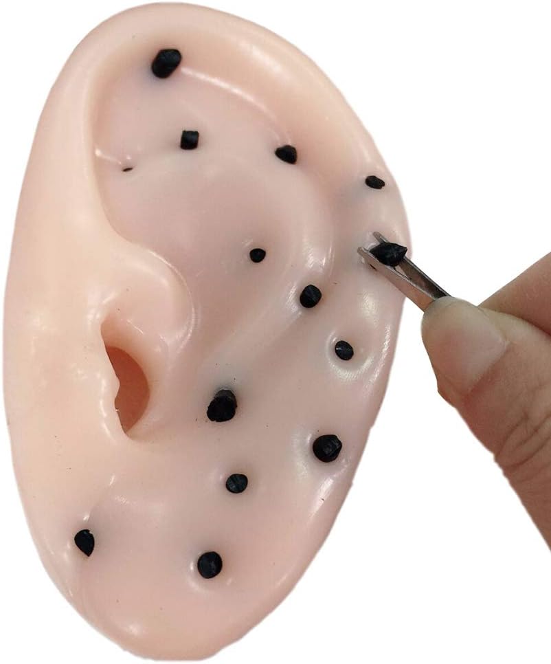 MAOJIE Ear Blackhead Removal Toy, Reusable Stress Reliver Anti-stress Blackhead Remover Toy Decompress Toys