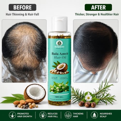 Image of KALPSHREE Hair Growth Oil 100 ml | Ayurvedic Hair Oil with Onion, Bhringraj, Almond, Jojoba, Rosemary | Dandruff & Hair Fall Control & Boost Hair Growth | For Men & Women | Scalp Nourishment & Hair Strengthening