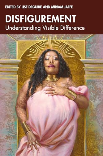 Disfigurement: Understanding Visible Difference (English Edition)