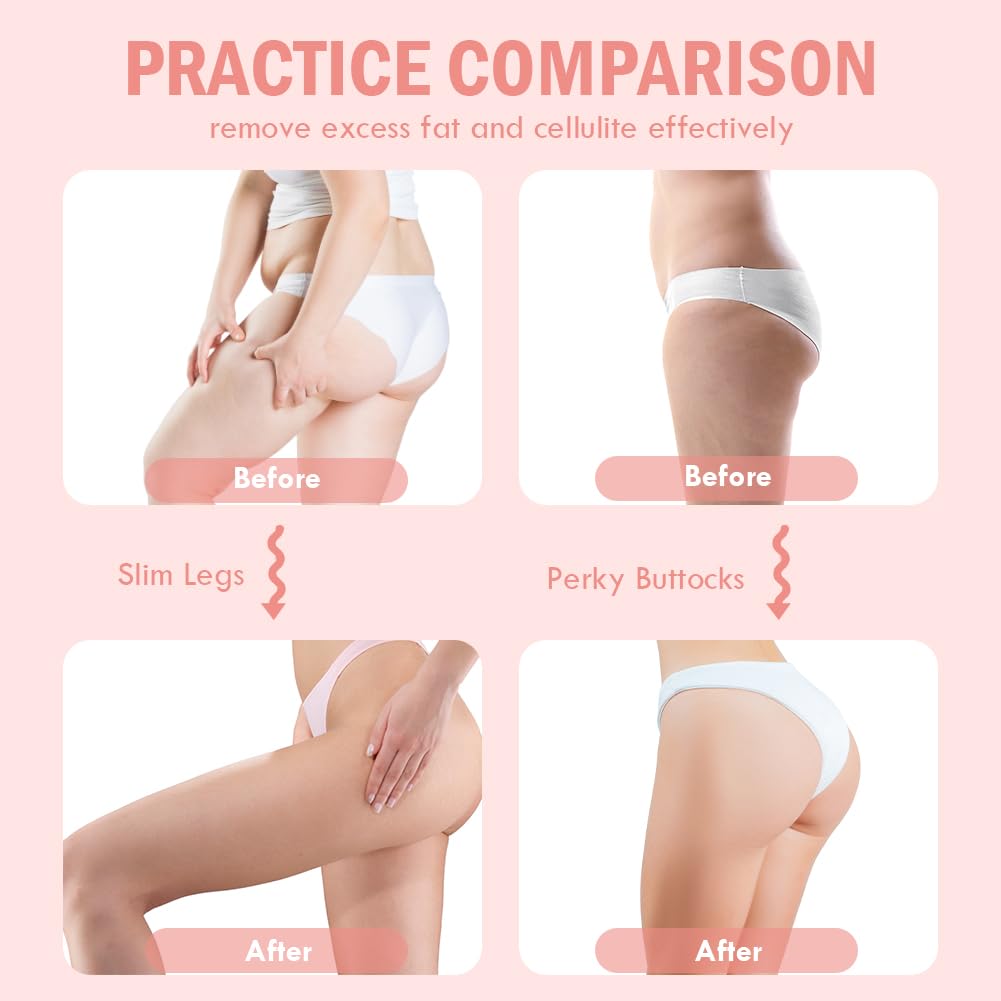 Flintronic Hip Trainer – Exerciceur Pelvien & Jambes Femme – Renforce Fessiers, Cuisses, Abdos – Post-Partum & Tonification