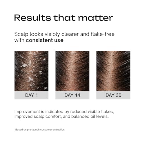 Image of Underated Anti-Dandruff Shampoo for Women & Men | Salicylic Acid, Piroctone Olamine & Climbazole | With Tea Tree Oil, Pro-Vitamin B5 & Rosemary | SLS-Free | Controls Hair Fall & Flakes | 200g