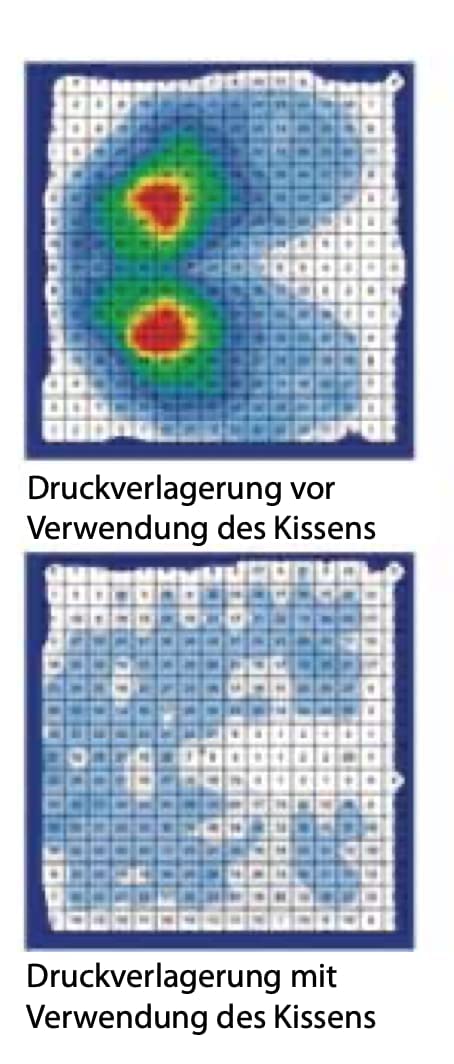 Antar SoNa24 - pneumatisches Steißbein-Anti Dekubitus Sitzkissen zur optimalen Druckentlastung AT52114 | Schmerzlinderung | Sitzkorrektur | 40x40x8cm