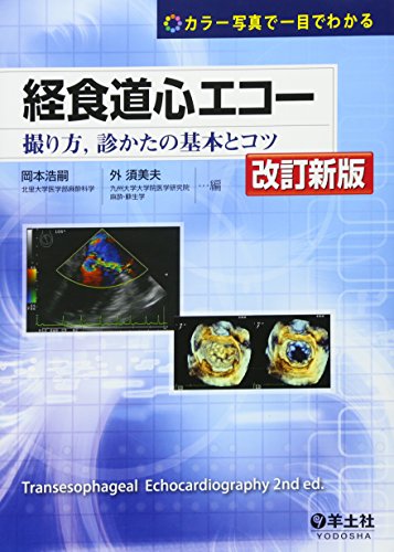 無料電子書籍 pdf 経食道心エコー―撮り方,診かたの基本とコツ バイ
