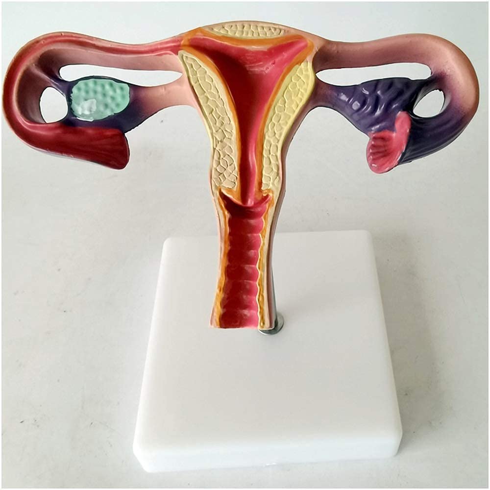 KJMWXOP Human Organ Anatomy Model Uterus Anatomical Model - Medical Anatomical Model Of Uterus And Ovary - For Study, Display, Teaching