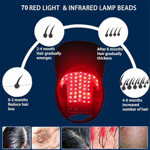 Bonnet de croissance capillaire 4 modes et 70 LED régénérantes