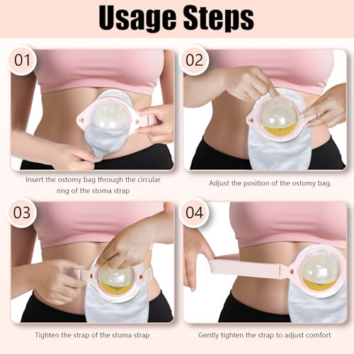 CYMNER 3 PCs Einstellbare stoma gürtel - Befestigt sicher an Stoma-Taschen(stoma zubehör), verhindert das Verziehen des Chassis, geeignet für die postoperative Versorgung nach Colostomy (Rosa)