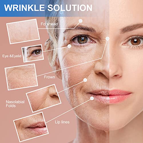 FORMIZON Cerotti Antirughe per il Viso, Face Lift