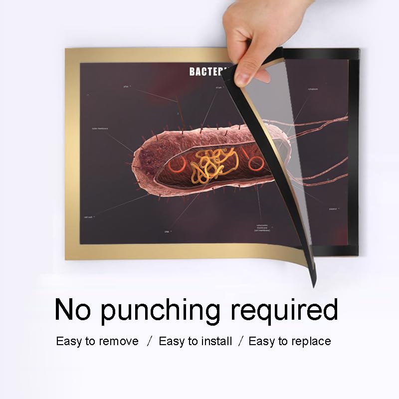 Image of Taanfu Body Educational Learning Anatomy Posters ，Bacterium Art Bacterium Villi Anatomy Art Poster Digestive System Organs Illustration Small Intestine Physiology Anatomy Wall Art Villi