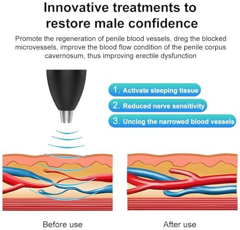 Portable Shockwave Therapy Machine, Handheld Quiet Extracorporeal E-D Shock Wave Therapy Devices, OLED Display, 3-Level Adjustment, for Body Muscle Relaxation