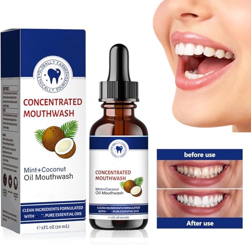 2 Stücke Kokosöl Mundspülung, Bio Kokosnuss-Mundspülung, Kokosöl-Pulling für Zähne, Kokosnussöl Mundwasser ätherisches ö, Frischer Atem & Aufhellende Mundspülung – Bild 3
