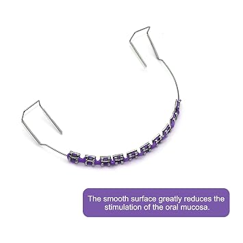 1-Set Temporary Tooth Decoration with Metal Wires, Metal Brackets and Orthodontic Ligature Ties, Ideal for Orthodontists to Explain and Dental Students to Practice (Purple)