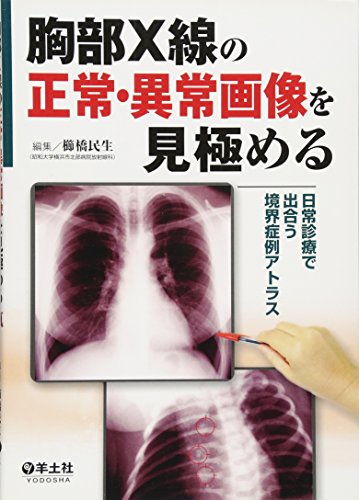 楽天 無料電子書籍 胸部X線の正常・異常画像を見極める―日常で出合う境界症例アトラス バイ