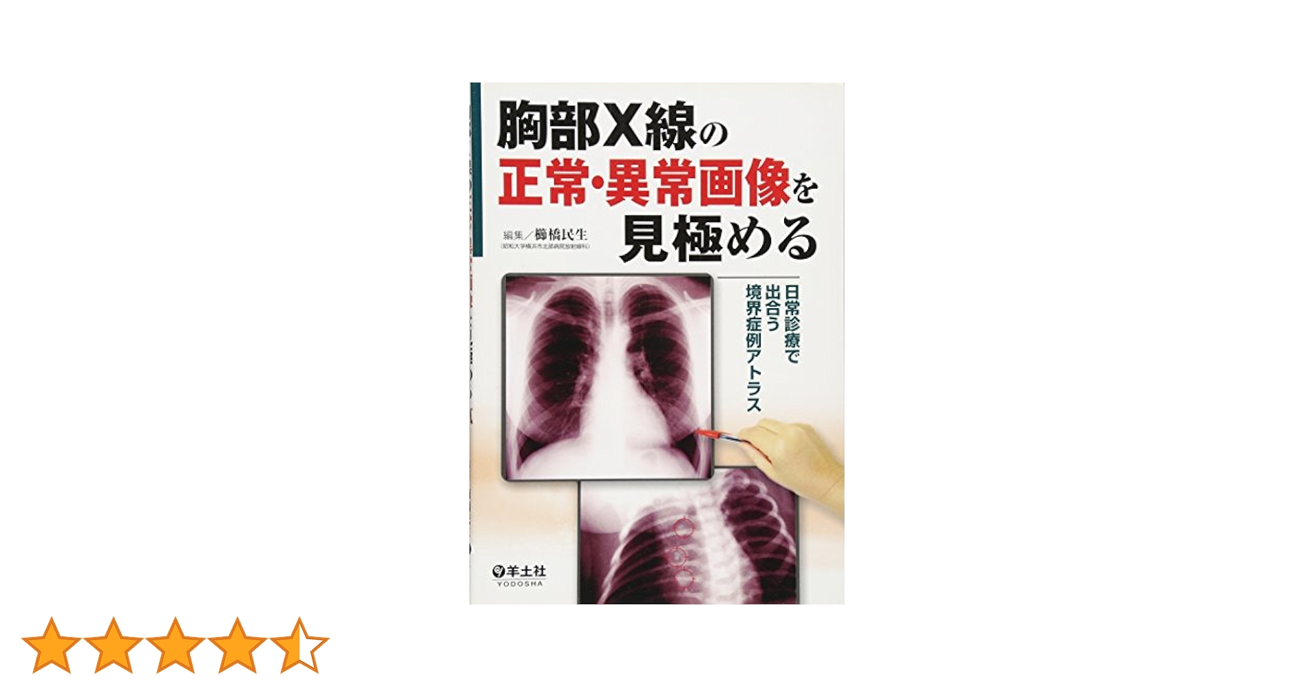 Amazon.co.jp: 胸部X線の正常・異常画像を見極める―日常で出合う